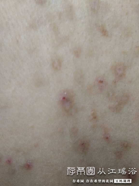 IMG20170414202950.jpg