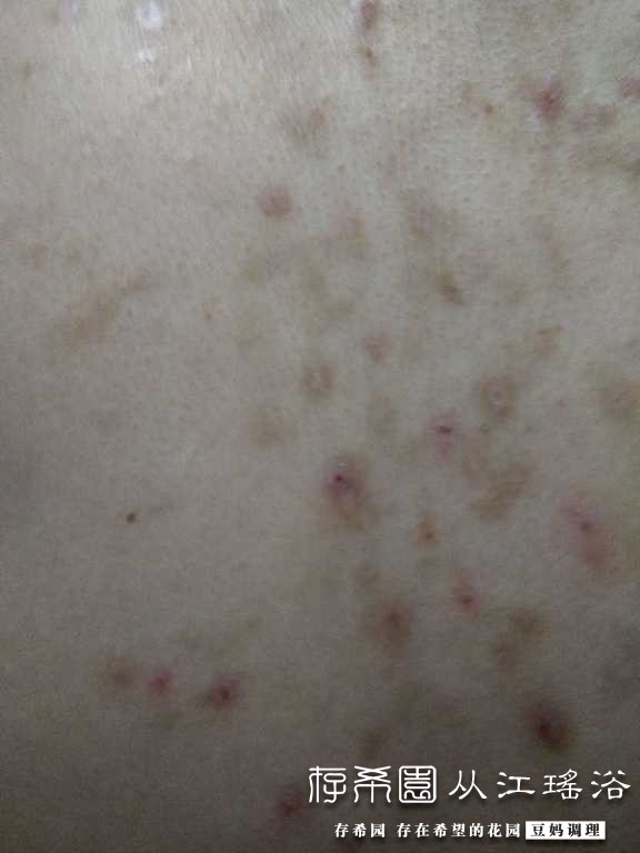 IMG20170414202940.jpg