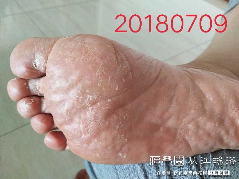 IMG_20180709_105737.JPG